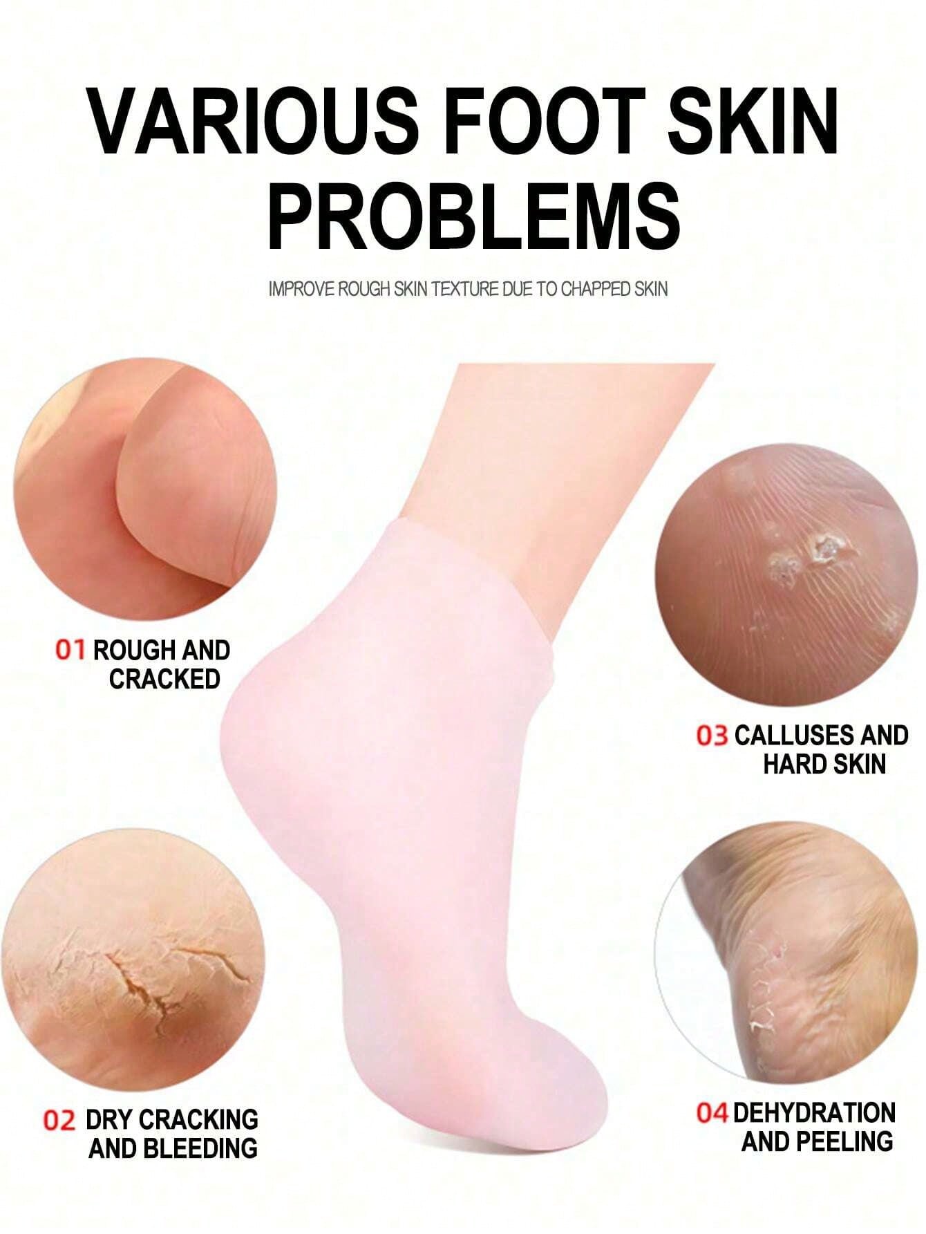 جوارب السيليكون لعناية القدم: ترطيب، تقشير، وعلاج الكعب المتشقق